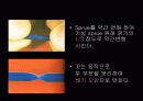 치기공 sprue 부착방법과 그 차이점 3페이지