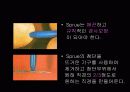 치기공 sprue 부착방법과 그 차이점 4페이지