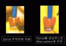 치기공 sprue 부착방법과 그 차이점 5페이지