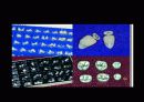 치기공 고정성 direct resin 의 구강외법 중 그 외법 8페이지