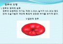 장 재활과 배변  32페이지