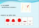 장 재활과 배변  33페이지