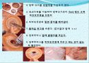 장 재활과 배변  40페이지