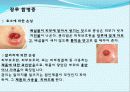 장 재활과 배변  41페이지