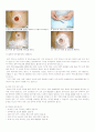 대장암 (colorectal cancer) 내용 정리 11페이지