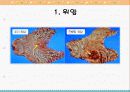 국가 5대 암의 원인과 증상, 예방법 3페이지