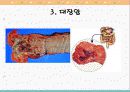 국가 5대 암의 원인과 증상, 예방법 7페이지