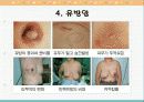 국가 5대 암의 원인과 증상, 예방법 9페이지