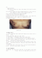 유방암 (병태생리, 과정,진단, 수술,수술후간호) 15페이지