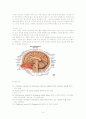 뇌내출혈 ICH ( intracerebral hemorrhage )  4페이지