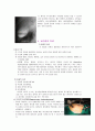 담석증(cholelithiasis) 병태생리 3페이지
