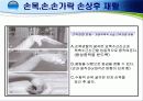손목 · 손 · 손가락 손상의 재활 17페이지