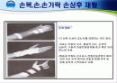손목 · 손 · 손가락 손상의 재활 20페이지