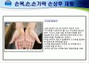 손목 · 손 · 손가락 손상의 재활 23페이지