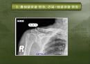 견관절 손상의 재활 17페이지