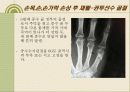 손목, 손, 손가락, 손상의 재활 30페이지