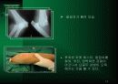 주관절 손상의 재활 14페이지
