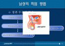 남성의 피임 방법 11페이지