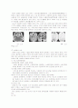 뇌종양케이스 4페이지