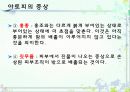 아토피성 피부염  6페이지