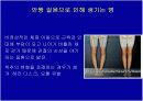 생활습관병인 안짱걸음의 운동처방 4페이지