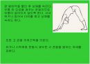생활습관병인 안짱걸음의 운동처방 8페이지