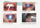 [치위생] 구강보건교육-불소도포 ppt 9페이지