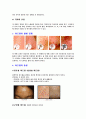 여드름 그 원인과 증상 및 치료방법 3페이지