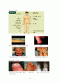 내분비계 (Endocrine System) 15페이지