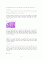 간 경화(liver cirrhosis, LC) case study 8페이지