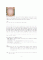 간 경화(liver cirrhosis, LC) case study 9페이지