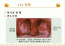 가정에서의 응급처치 27페이지