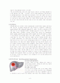 간세포 암종(Hepatocelluar carcinoma)환자 간호사례 연구 8페이지