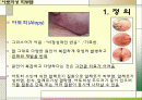 아토피성 피부염 2페이지
