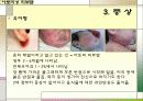 아토피성 피부염 8페이지