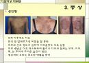 아토피성 피부염 10페이지