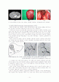 HCC(간세포암) Case study 12페이지