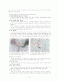 HCC(간세포암) Case study 13페이지