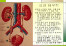 오줌요관(해부학, 요관결석, 이중요관) 2페이지