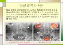 오줌요관(해부학, 요관결석, 이중요관) 7페이지