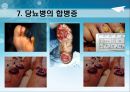당뇨병 예방과 식이-운동요법(식사요법) 21페이지