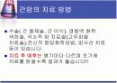 간암에 대한 보건교육 ppt 11페이지