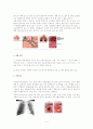 만성폐쇄성폐질환 2페이지