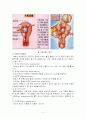 자궁근종( MYOMAUTERUS)수술환자에 대한 사례연구 2페이지
