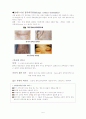 접촉성 피부염(간호) 2페이지