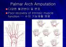 Replantation 수술후 관리  32페이지