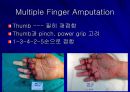Replantation 수술후 관리  33페이지
