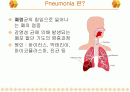 소아과 Case study - Pneumonia 2페이지