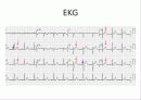 lung cancer 14페이지