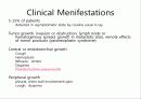lung cancer review 4페이지